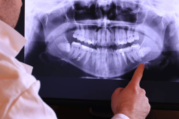Best Broken or Cracked Tooth Emergency Dentist in Brown Deer, WI